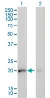 Merck MONOCLONAL ANTI-KRAS