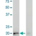 Merck MONOCLONAL ANTI-KRAS