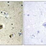 Merck ANTI-COLLAGEN IV ALPHA4