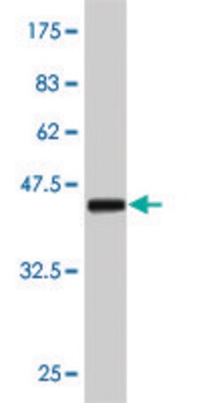 Merck Monoclonal Anti-ERBB2 antibody produced in mouse
