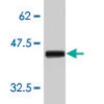 Merck Monoclonal Anti-ERBB2 antibody produced in mouse