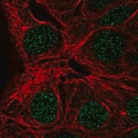 Merck Anti-MAGEA9 antibody produced in rabbit