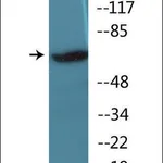 Merck Anti-phospho-IRAK1 (pThr209) antibody produced in rabbit