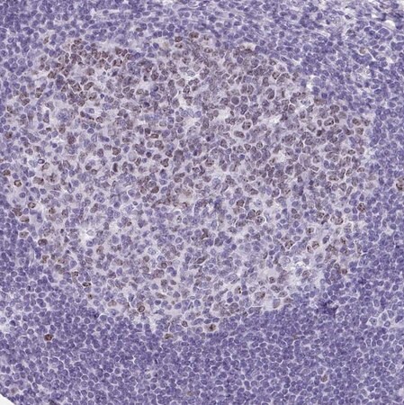 Merck Anti-SUZ12 antibody produced in rabbit
