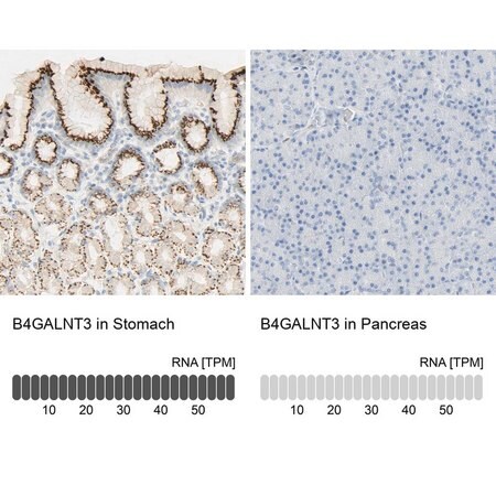 Merck Anti-B4GALNT3 antibody produced in rabbit