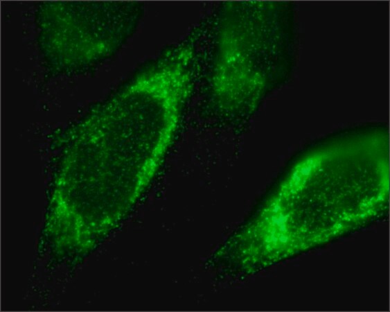 Merck Anti-TFRC antibody produced in rabbit
