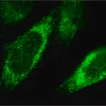 Merck Anti-TFRC antibody produced in rabbit