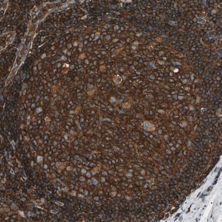 Merck Anti-ARPC2 antibody produced in rabbit