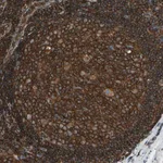 Merck Anti-ARPC2 antibody produced in rabbit