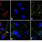 Thermo Fisher Scientific Donkey anti-Rabbit IgG (H+L) Cross-Adsorbed Secondary Antibody, DyLight 594