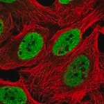 Merck Anti-INO80 antibody produced in rabbit