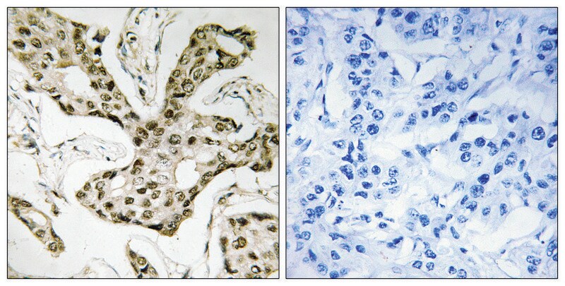 Merck Anti-TOP2A antibody produced in rabbit