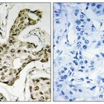 Merck Anti-TOP2A antibody produced in rabbit