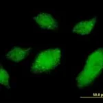 Merck MONOCLONAL ANTI-UBQLN1