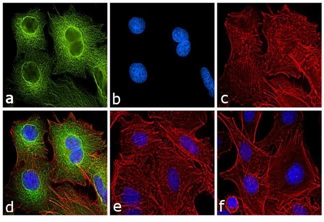 Thermo Fisher Scientific Rabbit anti-Rat IgG (H+L) Secondary Antibody, FITC