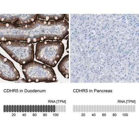 Merck Anti-CDHR5 antibody produced in rabbit