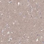 Merck Anti-DMTN antibody produced in rabbit