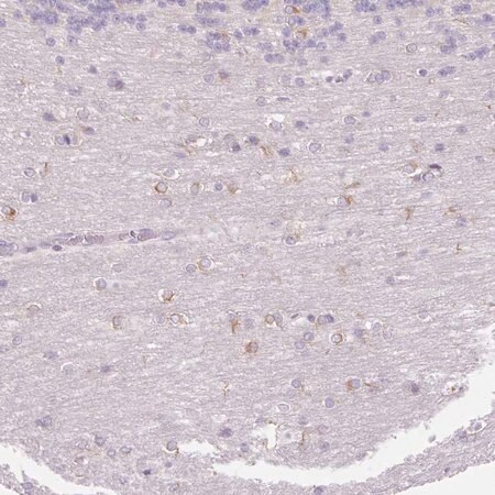 Merck Anti-FOCAD antibody produced in rabbit