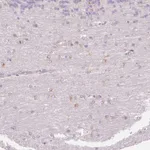 Merck Anti-FOCAD antibody produced in rabbit