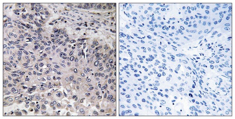 Merck Anti-C1QC antibody produced in rabbit