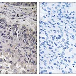 Merck Anti-C1QC antibody produced in rabbit
