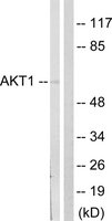 Merck ANTI-AKT