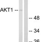 Merck ANTI-AKT