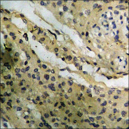 Merck Anti-phospho-GR (pSer226) antibody produced in rabbit