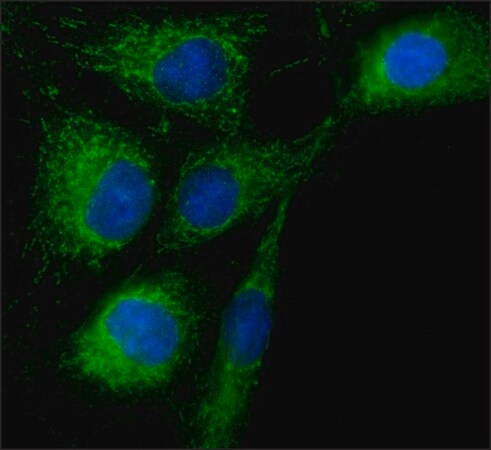 Merck Anti-Rab18 antibody produced in rabbit