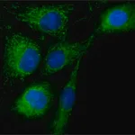 Merck Anti-Rab18 antibody produced in rabbit