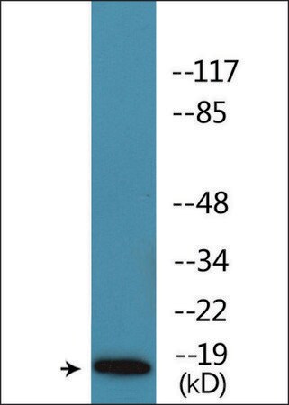 Merck Anti-phospho-Caveolin 2 (pTyr27) antibody produced in rabbit