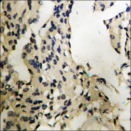 Merck Anti-phospho-MEF2C (pSer396) antibody produced in rabbit