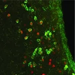 Merck RABBIT ANTI-CFOS, IGG FRACTION