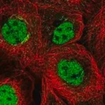 Merck Anti-PCGF5 antibody produced in rabbit