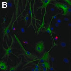 Merck MOUSE MONOCLONAL ANTI-MAP2 CLONE HM-2  &
