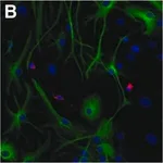 Merck MOUSE MONOCLONAL ANTI-MAP2 CLONE HM-2 &