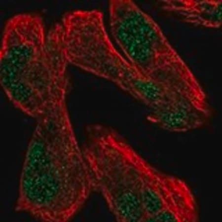 Merck Anti-USP12 antibody produced in rabbit