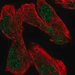 Merck Anti-USP12 antibody produced in rabbit