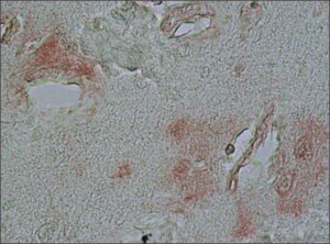 Merck ANTI-ALPHA-SYNUCLEIN , DEVELOPED IN &