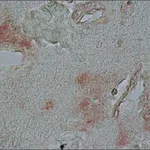 Merck ANTI-ALPHA-SYNUCLEIN , DEVELOPED IN &