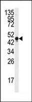 Merck ANTI-NSE (Y236)