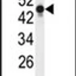 Merck ANTI-NSE (Y236)