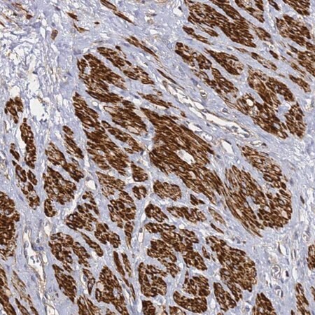 Merck Anti-ZFP36L2 antibody produced in rabbit