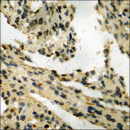 Merck Anti-phospho-Retinoblastoma (pSer795) antibody produced in rabbit
