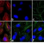Thermo Fisher Scientific Goat anti-Rabbit IgG (H+L) Secondary Antibody, TRITC