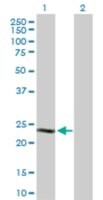 Merck ANTI-CSN1S1