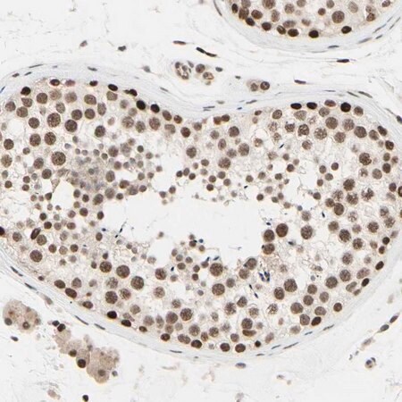 Merck Anti-SUFU antibody produced in rabbit