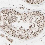 Merck Anti-SUFU antibody produced in rabbit