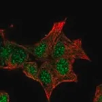 Merck Anti-GCKR antibody produced in rabbit