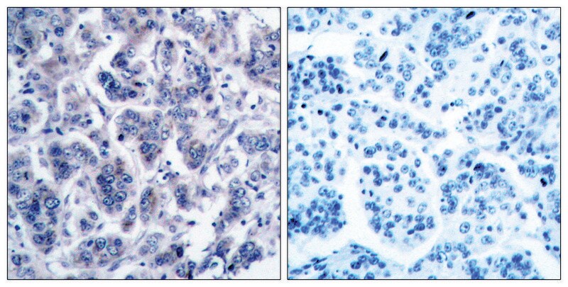 Merck Anti-TYK2 antibody produced in rabbit